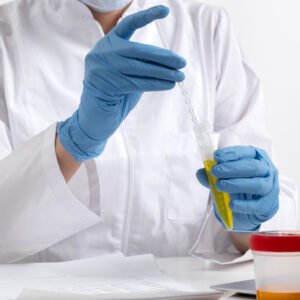 Mycotoxins Testing, Detection & Analysis